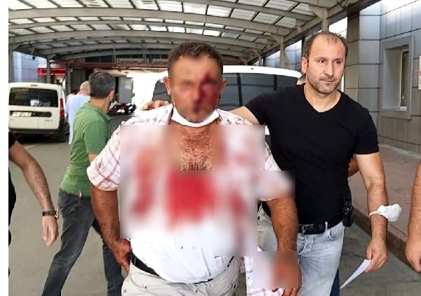 SALÇA KAZANI YÜZÜNDEN OĞLUNU ÖLDÜRDÜ