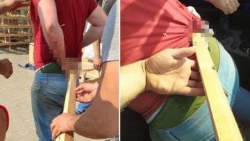 FIRLAYAN AĞAÇ PARÇASI KARNINDAN GİRİP SIRTINDAN ÇIKTI